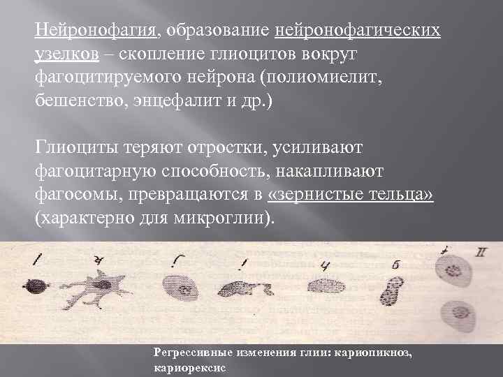 Нейронофагия, образование нейронофагических узелков – скопление глиоцитов вокруг фагоцитируемого нейрона (полиомиелит, бешенство, энцефалит и