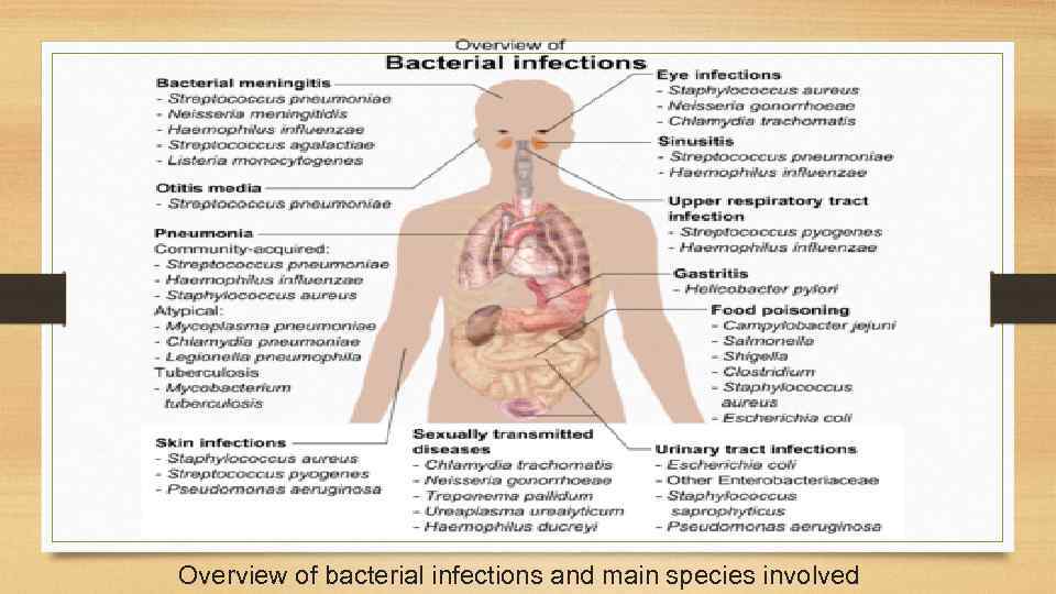 Overview of bacterial infections and main species involved 