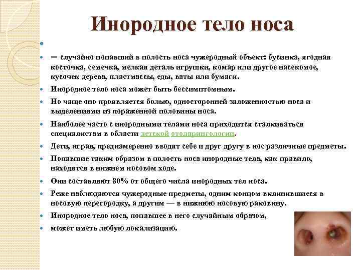Инородное тело носа — случайно попавший в полость носа чужеродный объект: бусинка, ягодная косточка,