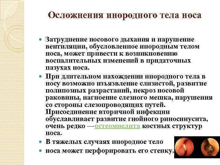 Осложнения инородного тела носа Затруднение носового дыхания и нарушение вентиляции, обусловленное инородным телом носа,
