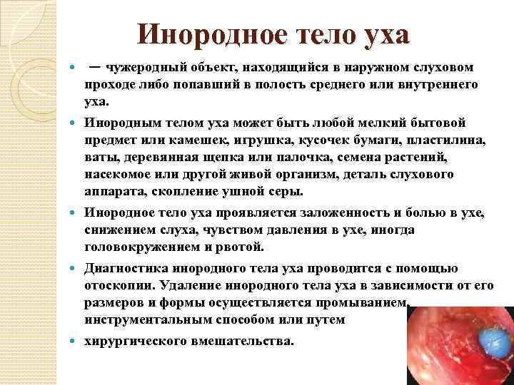 Инородное тело уха — чужеродный объект, находящийся в наружном слуховом проходе либо попавший в