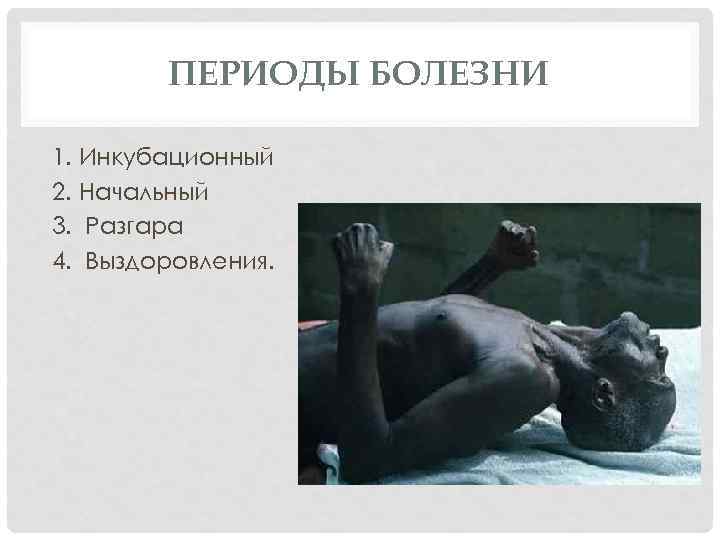 ПЕРИОДЫ БОЛЕЗНИ 1. Инкубационный 2. Начальный 3. Разгара 4. Выздоровления. 