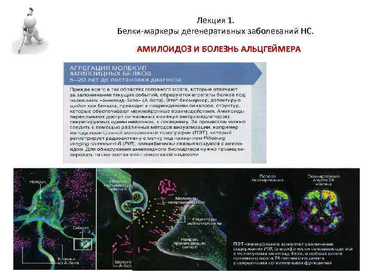 Лекция 1. Белки-маркеры дегенеративных заболеваний НС. АМИЛОИДОЗ И БОЛЕЗНЬ АЛЬЦГЕЙМЕРА 
