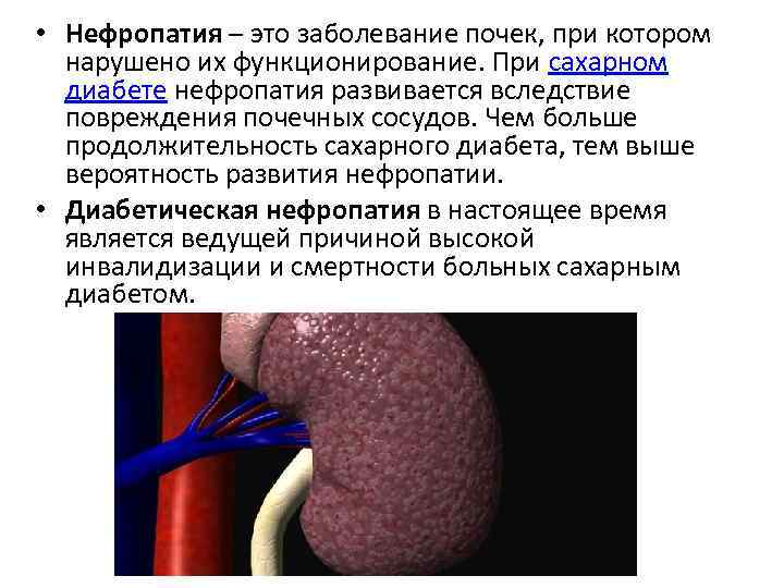  • Нефропатия – это заболевание почек, при котором нарушено их функционирование. При сахарном