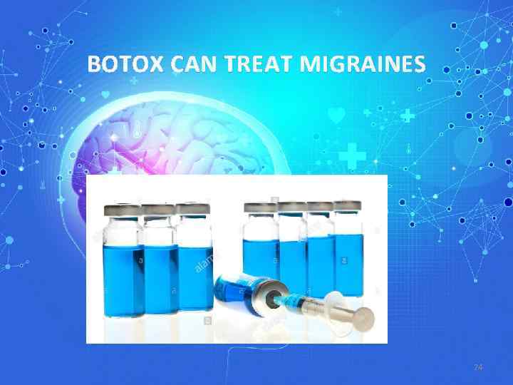 BOTOX CAN TREAT MIGRAINES 24 