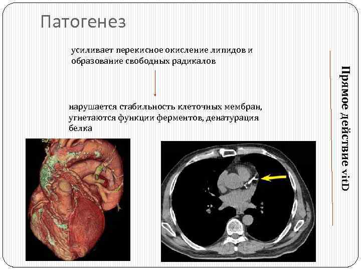 Патогенез нарушается стабильность клеточных мембран, угнетаются функции ферментов, денатурация белка Прямое действие vit. D