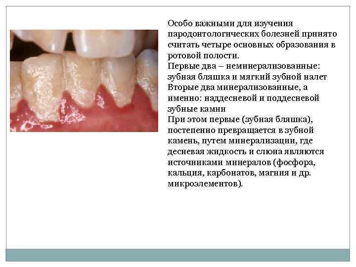 Особо важными для изучения пародонтологических болезней принято считать четыре основных образования в ротовой полости.