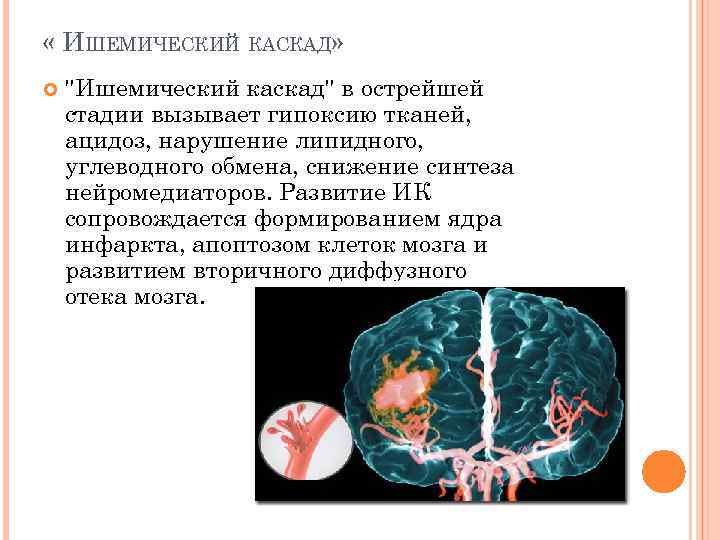  « ИШЕМИЧЕСКИЙ КАСКАД» ''Ишемический каскад'' в острейшей стадии вызывает гипоксию тканей, ацидоз, нарушение