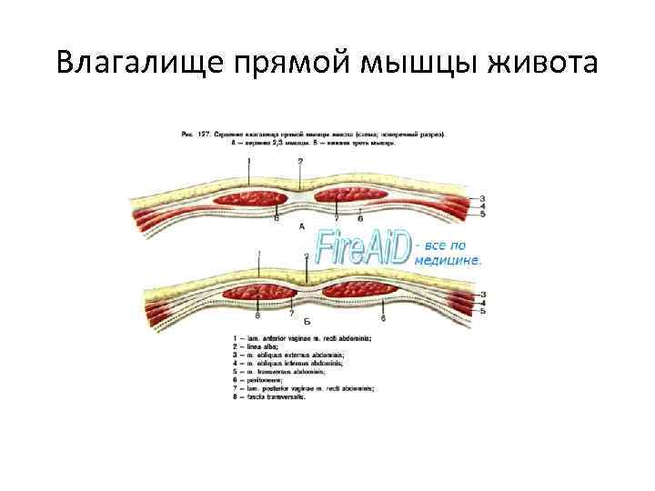 Влагалище прямой мышцы живота 