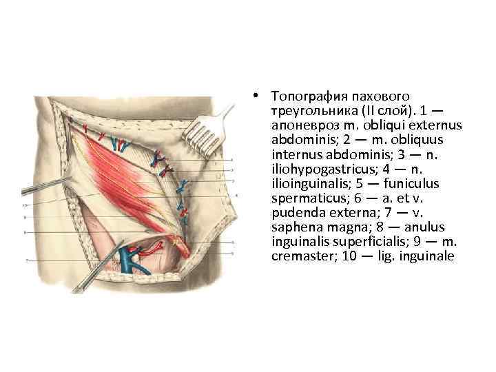  • Топография пахового треугольника (II слой). 1 — апоневроз m. obliqui externus abdominis;