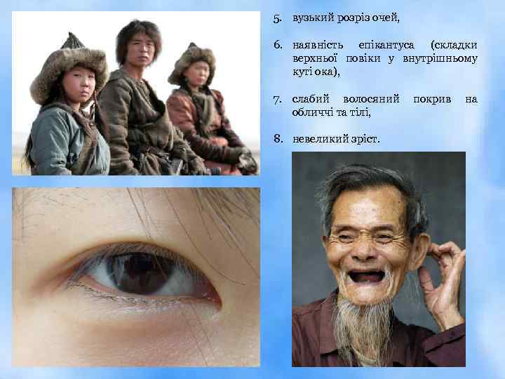5. вузький розріз очей, 6. наявність епікантуса (складки верхньої повіки у внутрішньому куті ока),