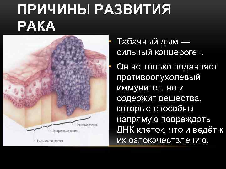 ПРИЧИНЫ РАЗВИТИЯ РАКА • Табачный дым — сильный канцероген. • Он не только подавляет