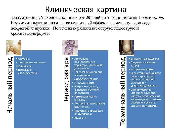  Клиническая картина • Лихорадка волнообразного характера (до 39 -40 С), длительная • Гепатоспленомегалия