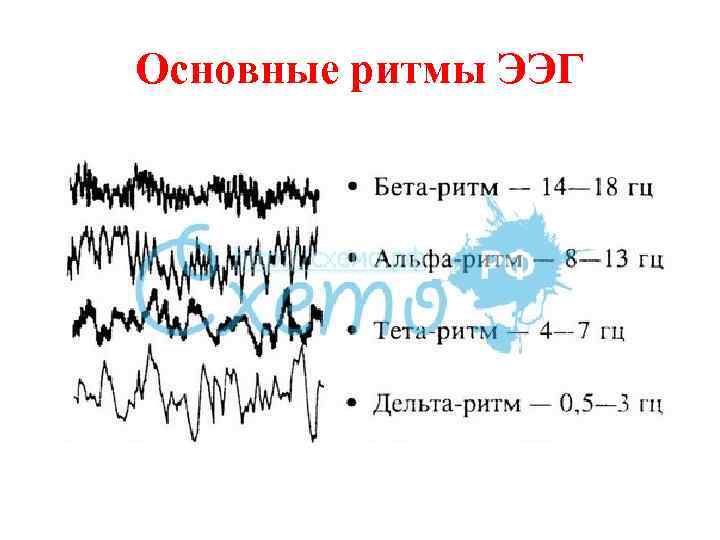 Основной ритм. Дельта ритм ЭЭГ. Соотнесите тета-ритм ЭЭГ С его характеристикой:. Альфа волны ЭЭГ. Бета ритм по ЭЭГ.