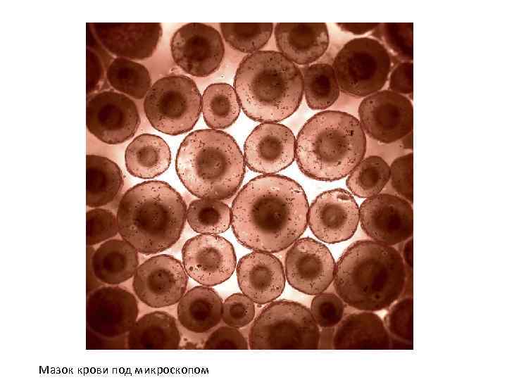 Мазок крови под микроскопом 