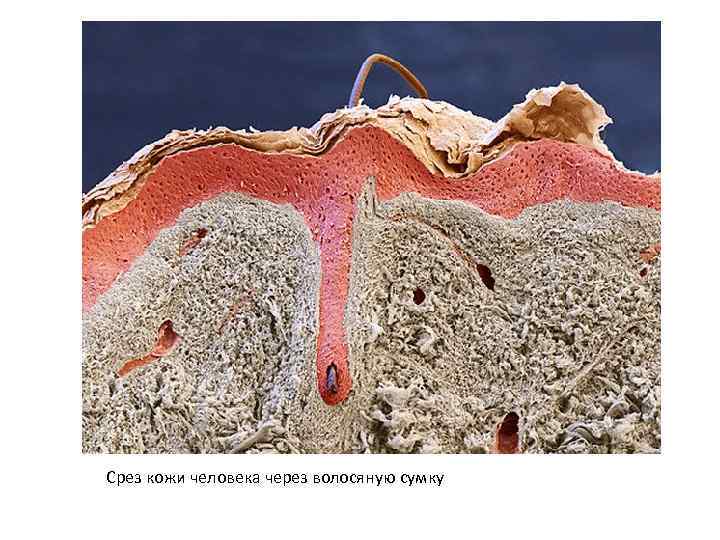 Срез кожи человека через волосяную сумку 