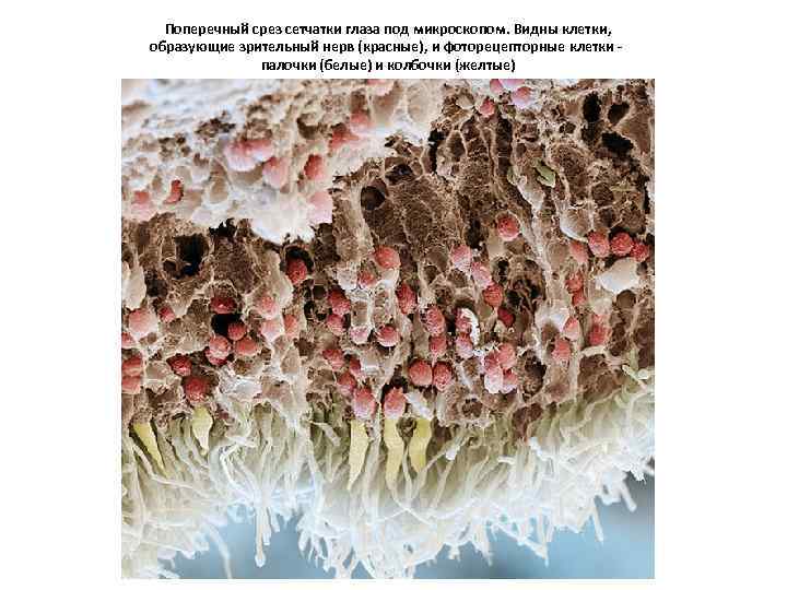 Поперечный срез сетчатки глаза под микроскопом. Видны клетки, образующие зрительный нерв (красные), и фоторецепторные