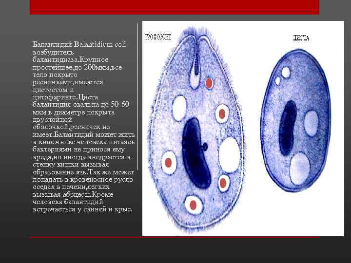 Какое значение в жизни простейших имеют цисты. Вегетативная форма балантидия. Циста балантидия. Вегетативная форма Balantidium coli. Балантидий циста и трофозоит.