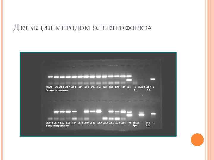 ДЕТЕКЦИЯ МЕТОДОМ ЭЛЕКТРОФОРЕЗА 