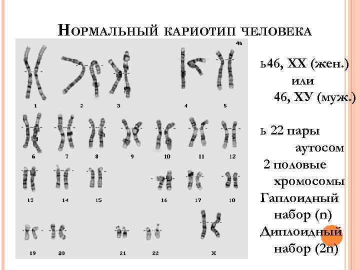 Хромосомы нормального человека. 46 XY набор хромосом. Нормальный кариотип человека 46 хромосом. 46,XY нормальный мужской кариотип. Кариотип 46хх), человек.