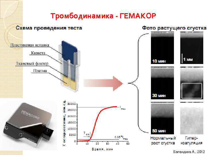 Тромбодинамика - ГЕМАКОР Баландина А. , 2012 