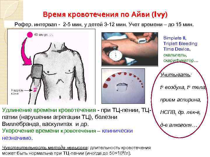 Время кровотечения по Айви (Ivy) Рефер. интервал - 2 -5 мин, у детей 3