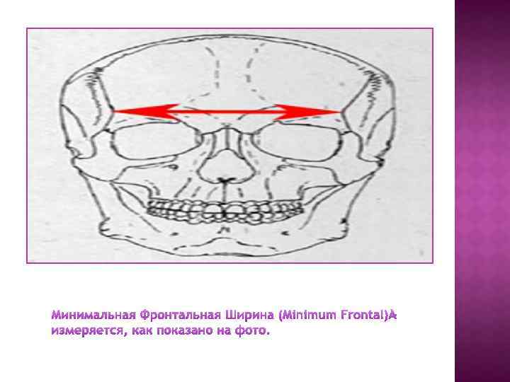 Минимальная Фронтальная Ширина (Minimum Frontal) измеряется, как показано на фото. 