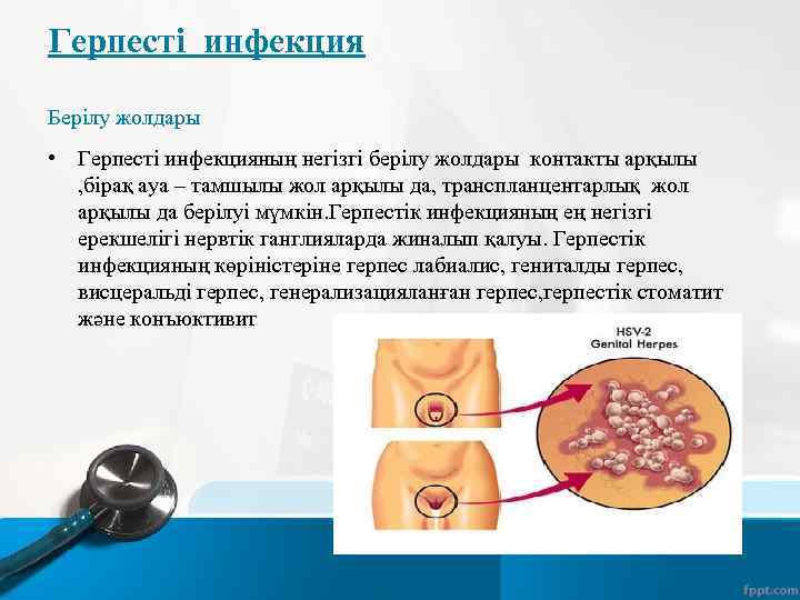 Герпесті инфекция Берілу жолдары • Герпесті инфекцияның негізгі берілу жолдары контакты арқылы , бірақ