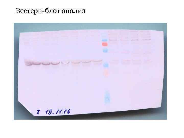 Вестерн-блот анализ 