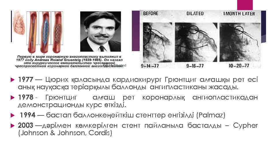 1977 — Цюрих қаласында кардиохирург Грюнтциг алғашқы рет есі анық науқасқа теріарқылы баллонды ангипластиканы
