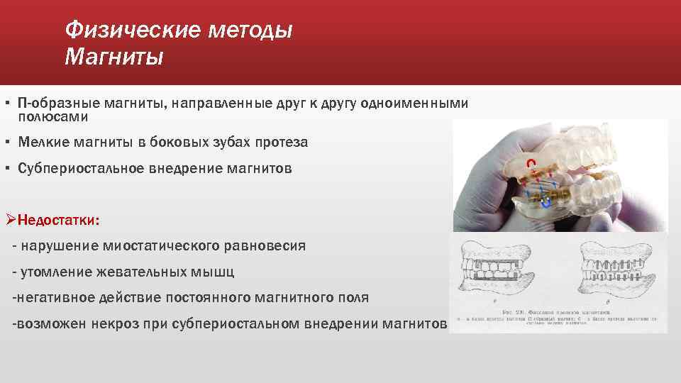 Физические методы Магниты ▪ П-образные магниты, направленные друг к другу одноименными полюсами ▪ Мелкие