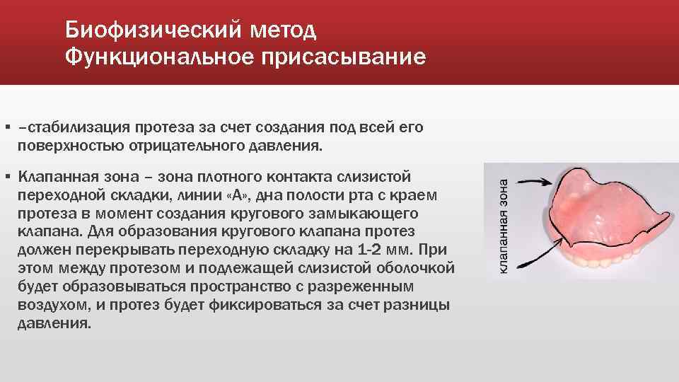 Биофизический метод Функциональное присасывание ▪ –стабилизация протеза за счет создания под всей его поверхностью