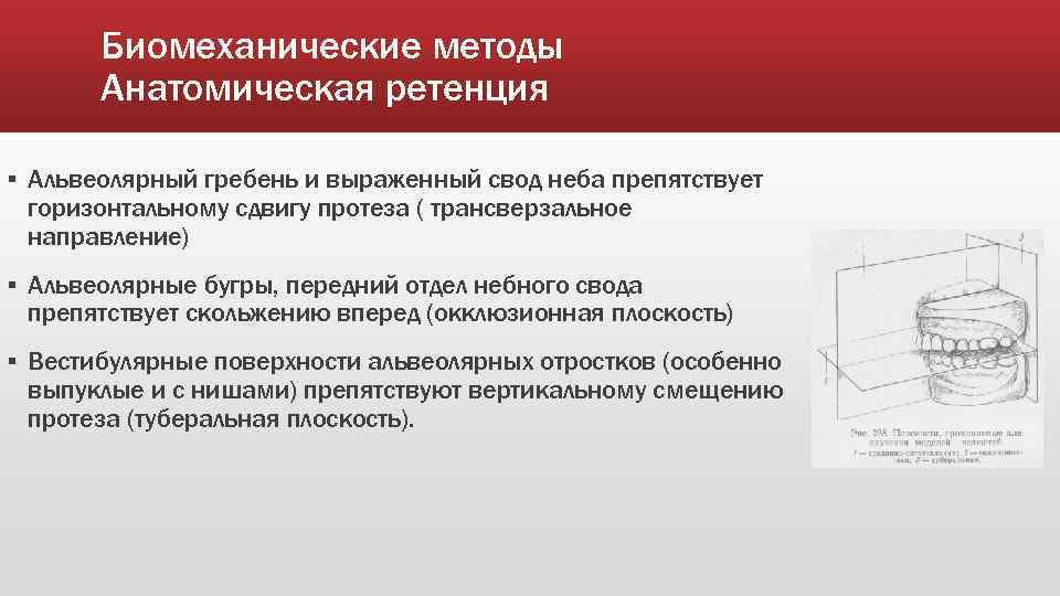 Биомеханические методы Анатомическая ретенция ▪ Альвеолярный гребень и выраженный свод неба препятствует горизонтальному сдвигу