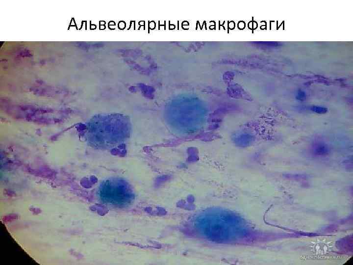 Альвеолярные макрофаги 