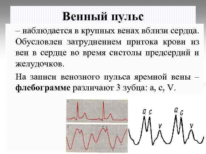 Венный пульс – наблюдается в крупных венах вблизи сердца. Обусловлен затруднением притока крови из