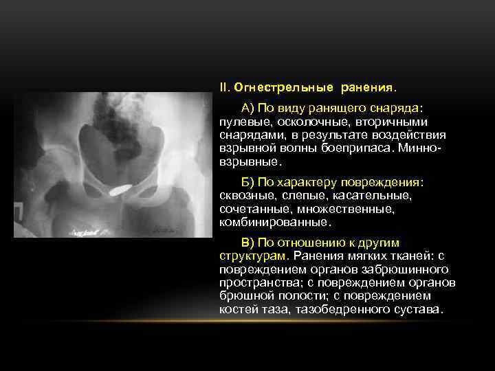 II. Огнестрельные ранения. А) По виду ранящего снаряда: пулевые, осколочные, вторичными снарядами, в результате