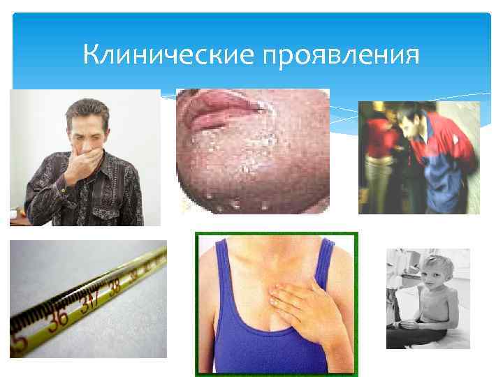 Клинические проявления 