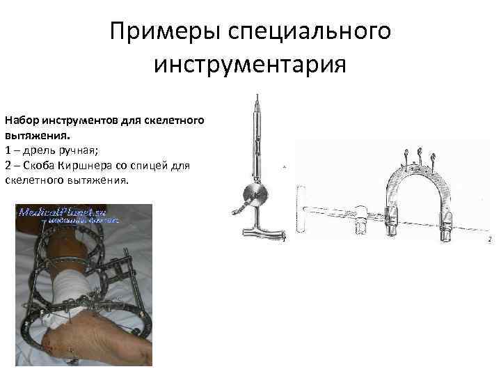 Скелетное вытяжение презентация