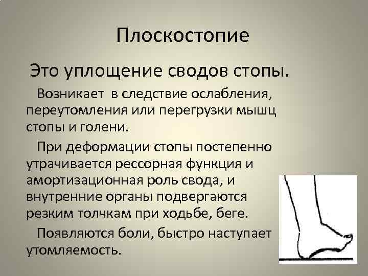 Плоскостопие Это уплощение сводов стопы. Возникает в следствие ослабления, переутомления или перегрузки мышц стопы