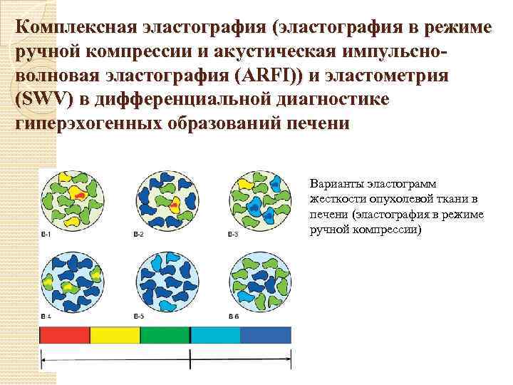 Комплексная эластография (эластография в режиме ручной компрессии и акустическая импульсноволновая эластография (ARFI)) и эластометрия