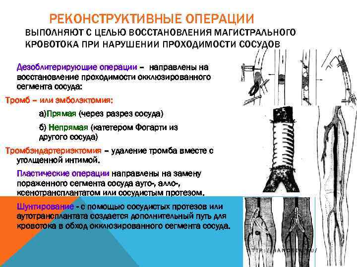 РЕКОНСТРУКТИВНЫЕ ОПЕРАЦИИ ВЫПОЛНЯЮТ С ЦЕЛЬЮ ВОССТАНОВЛЕНИЯ МАГИСТРАЛЬНОГО КРОВОТОКА ПРИ НАРУШЕНИИ ПРОХОДИМОСТИ СОСУДОВ Дезоблитерирующие операции