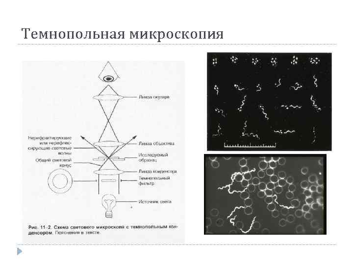 В методе темного поля микроскопии изображение объекта получается