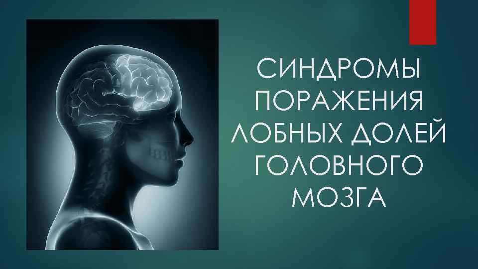 Поражение долей. Синдром поражения лобной доли головного мозга. Синдромы поражения лобной доли. Синдромы поражения лобных долей мозга. Симптомокомплексы поражения долей головного мозга.