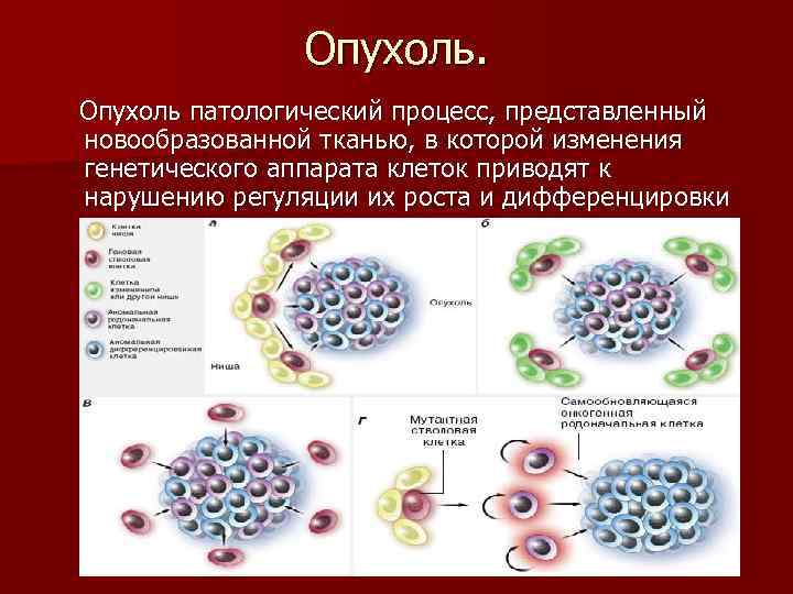 Опухоль патологический процесс, представленный новообразованной тканью, в которой изменения генетического аппарата клеток приводят к