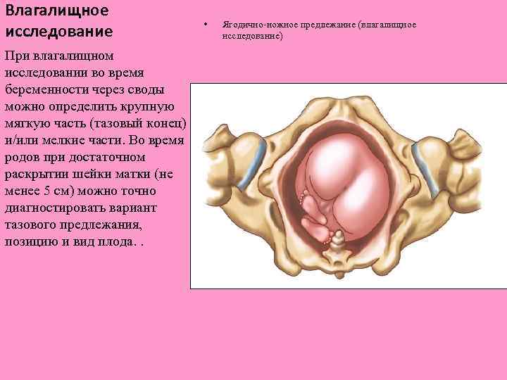 Влагалищное исследование При влагалищном исследовании во время беременности через своды можно определить крупную мягкую