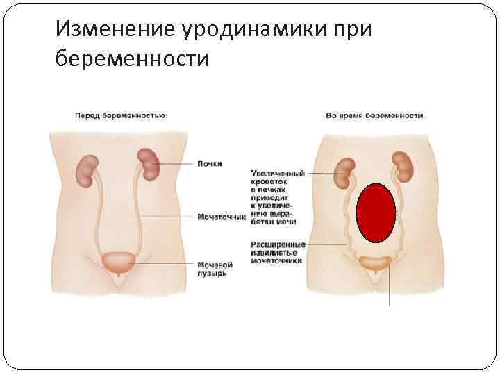 Изменение уродинамики при беременности 