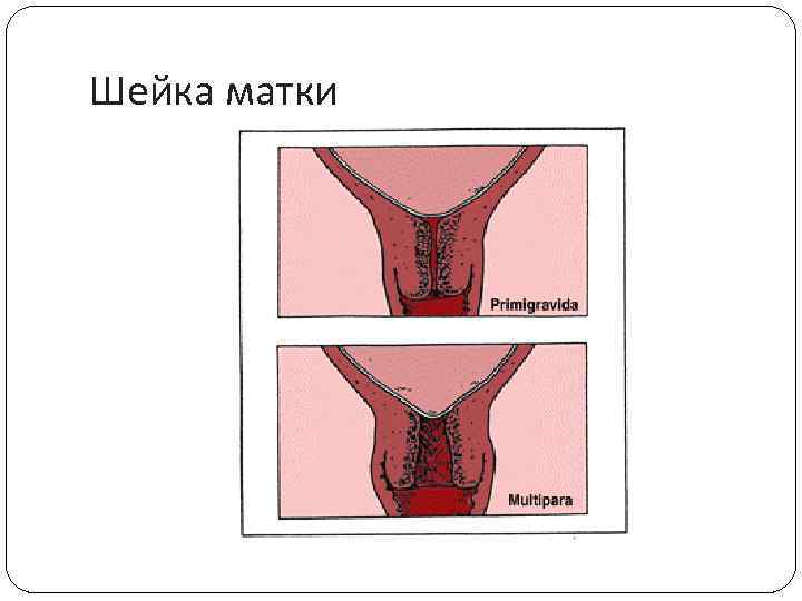 Шейка матки 