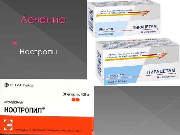 Лечение Ноотропы 