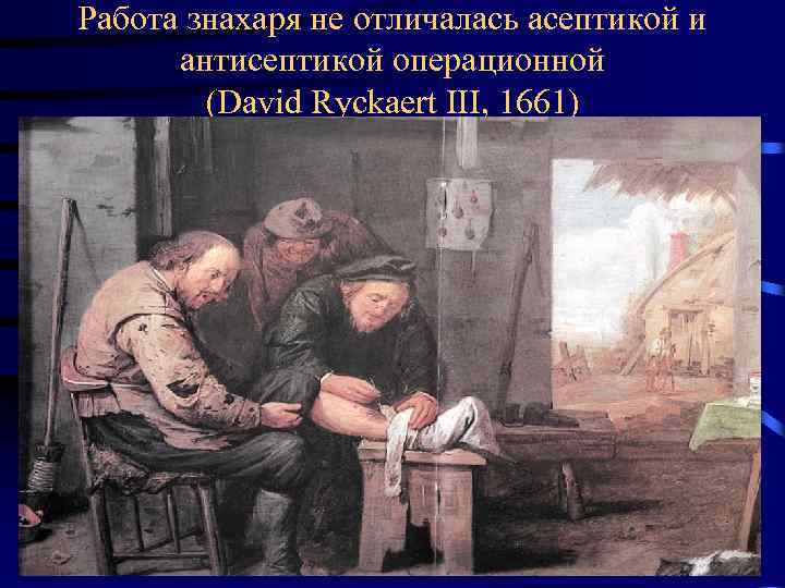 Работа знахаря не отличалась асептикой и антисептикой операционной (David Ryckaert III, 1661) 