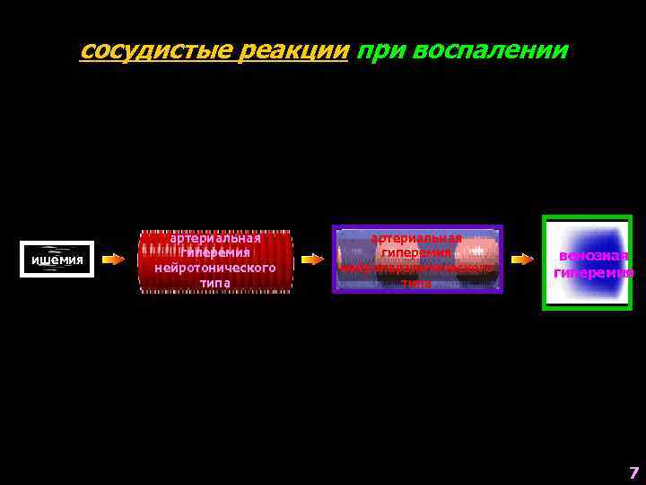 сосудистые реакции при воспалении ишемия артериальная гиперемия нейротонического типа артериальная гиперемия нейропаралитического типа венозная